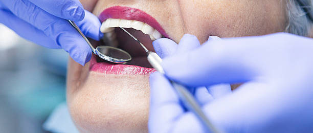 Best Emergency Treatment for Dental Infections or Abscesses in Weatogue, CT